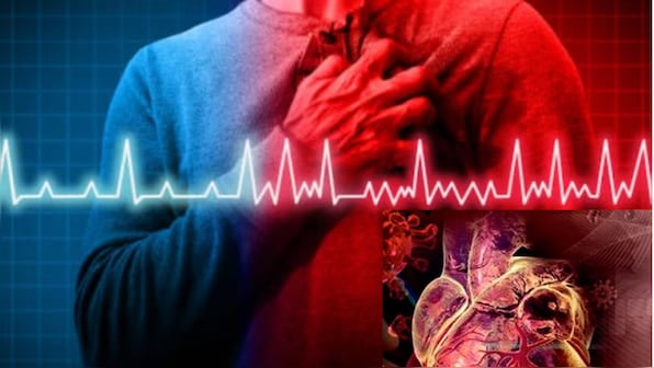 Doctor explains: How intense workouts & lifestyle choices trigger heart attacks among youth