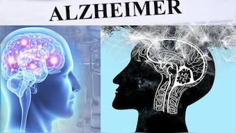 The number of individuals living with Alzheimer's is expected to double from 6.9 million in 2020 to nearly 14 million by 2060. It ranks as the sixth leading cause of death among adults aged 65 and older.