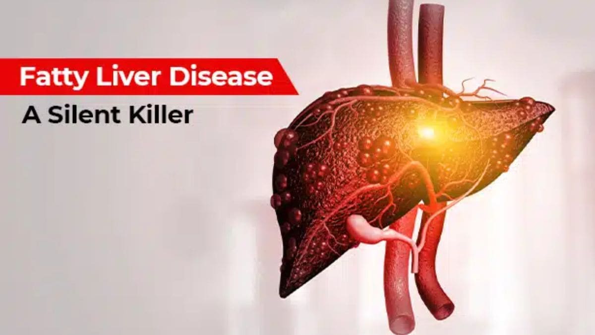 Doctor explains: How lifestyle choices & genetics drive alarming surge in fatty liver disease