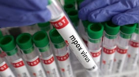 Kerala confirms second mpox case, again a UAE return youth tests positive