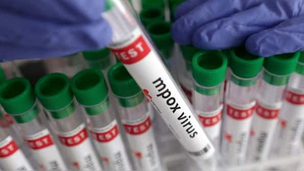 Kerala confirms second mpox case, again a UAE return youth tests positive