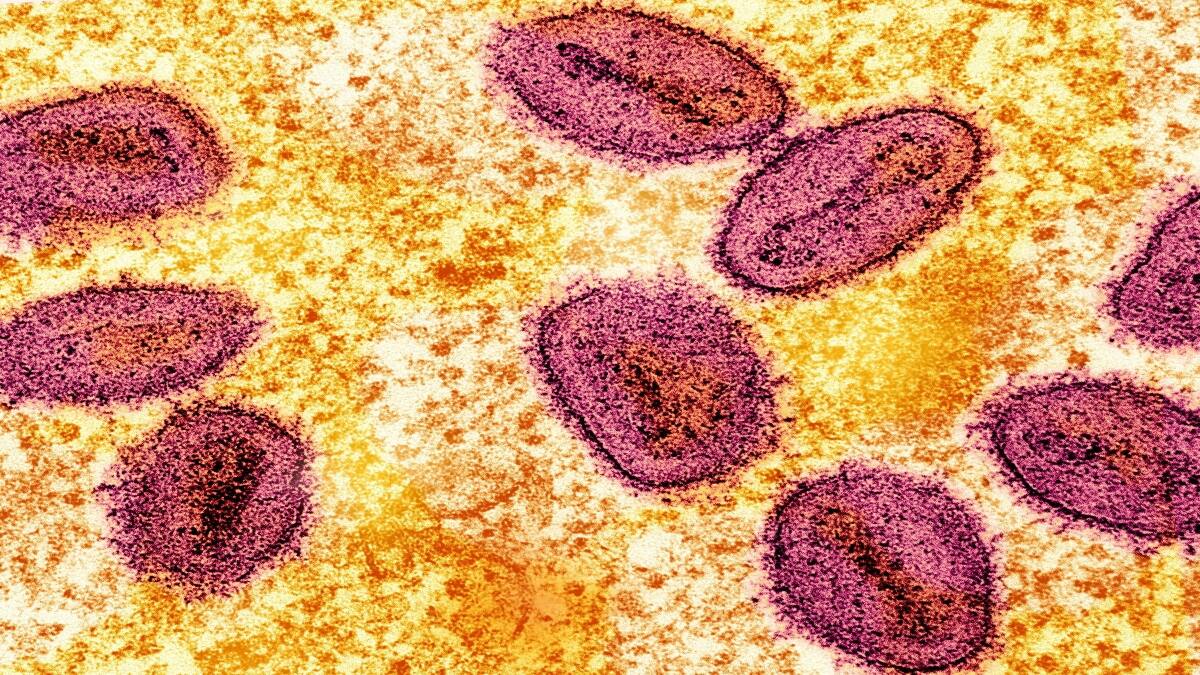 UK detects first case of new Mpox variant clade Ib – Firstpost