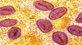 UK detects first case of new Mpox variant clade Ib