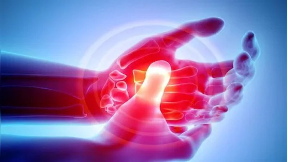 Experts call arthritis a 'silent epidemic,' urge early diagnosis to prevent lasting damage Experts call arthritis a 'silent epidemic,' urge early diagnosis to prevent lasting damage