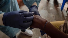 800 deaths, cases in 16 African countries: WHO approves first mpox diagnostic test kit
