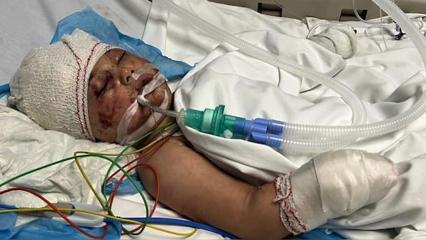 A little miracle: Toddler buried under rubble for 14 hours after Israel's deadly attack on Lebanon rescued