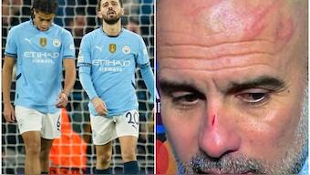 Manager Pep Guardiola revealed the reason behind scratches on his face following Manchester City's 3-3 draw against Feyenoord in the UEFA Champions League. AP / Screengrab 