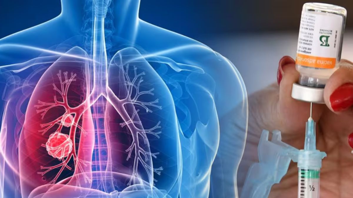 Representative Image- FP Representative Image- FP