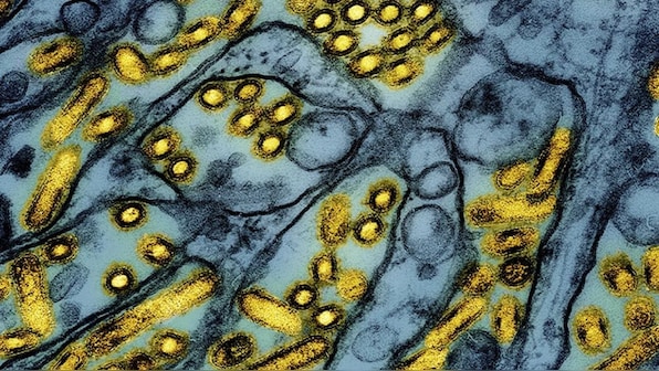 US reports first case of bird flu in a minor, human-to-human spread is still uncertain