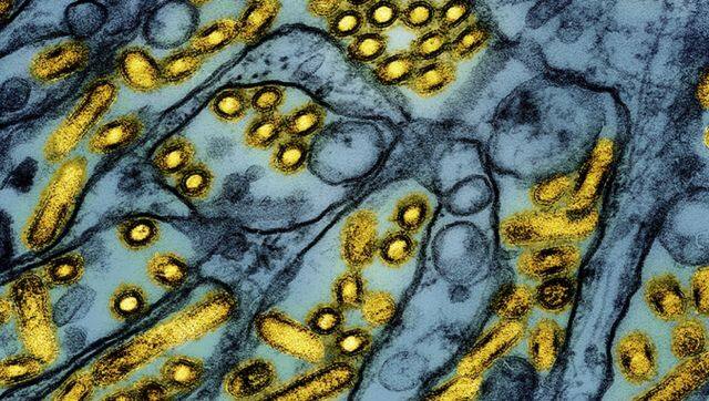 This electron microscope image released by the National Institute of allergy and Infectious Diseases shows avian influenza A H5N1 virus particles (yellow). AP