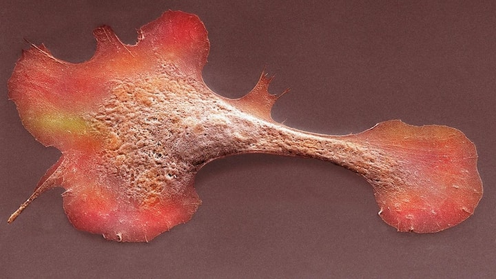 Scientists develop a patch to repair hearts: Why this is groundbreaking Scientists develop a patch to repair hearts: Why this is groundbreaking