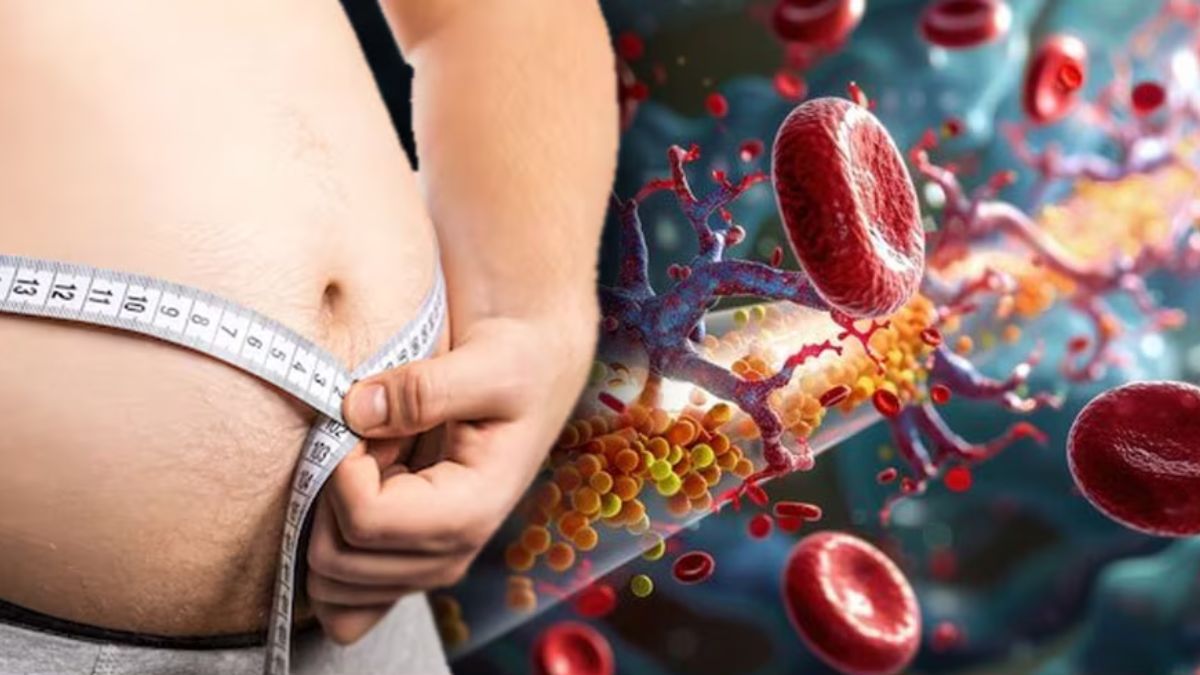 Representational Image- FP Representational Image- FP