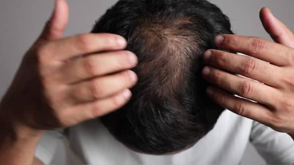 Maharashtra's 'hair loss mystery': Why have villagers gone bald in a week?