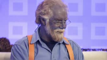  Paul Karason as a “blue man” after he attempted to cure sinus and skin problems by ingesting a homemade silver chloride solution. Image courtesy: Moneycontrol
