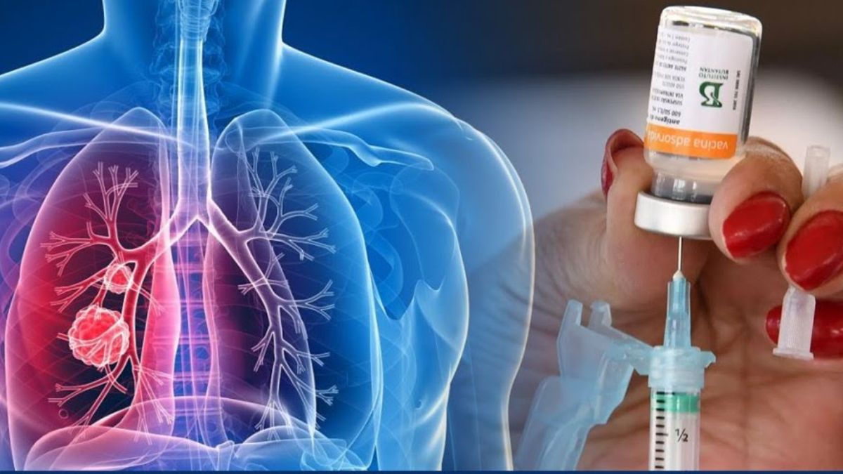 Healthcare experts hail Budget 2025’s push for daycare cancer centers, drug cost relief Healthcare experts hail Budget 2025’s push for daycare cancer centers, drug cost relief