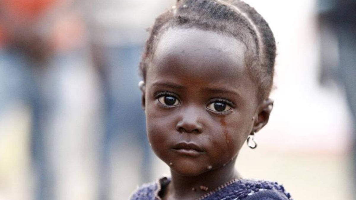 What’s the mysterious ‘crying disease’ that has claimed 60 lives in Congo? What’s the mysterious ‘crying disease’ that has claimed 60 lives in Congo?