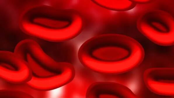 National Anaemia Day: When should anaemia patients consider a bone marrow transplant?