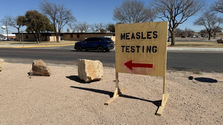 US reports nearly 500 confirmed cases of measles, Texas worst hit US reports nearly 500 confirmed cases of measles, Texas worst hit
