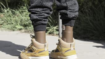 A young boy who lost his leg during the recent war walks with his mother during a visit at Ortho-Physiotherapy Centre in Mekele, Tigray, Ethiopia Friday, Feb. 14, 2025. (AP Photo/Amanuel Birhane)