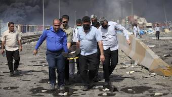In this photo provided by Islamic Republic News Agency, IRNA, men carry an injured man after a massive explosion near the southern port city of Bandar Abbas, Iran. AP
