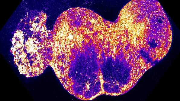 In a first, scientists create brain circuit that can transmit sensation of pain