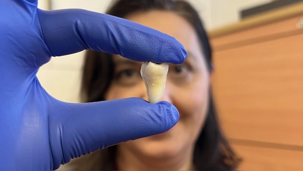 No more fillings or implants? Why world’s first lab-grown teeth are a big deal