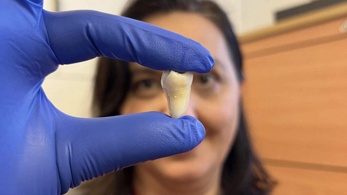 No more fillings or implants? Why world’s first lab-grown teeth are a ...
