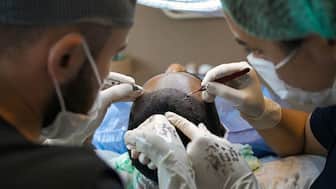 A hair transplant is usually a safe procedure. Representational Image/Pixabay