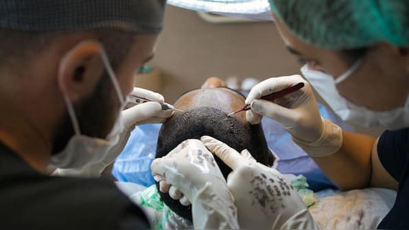 2 Kanpur men die after ‘hair transplant’: How safe is this cosmetic procedure?