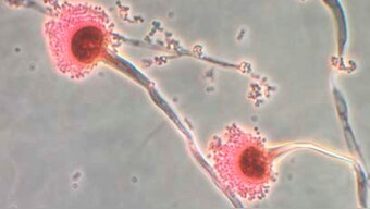 Aspergillus, a type of fungi, is seen in this handout image from the Centres for Disease Control, October 13, 2012. File Photo/Reuters