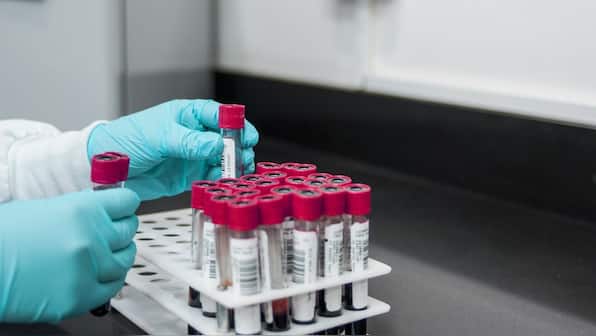 How new blood test could reveal cancer long before symptoms appear