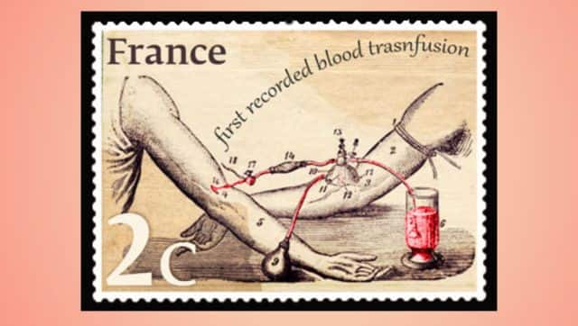 History Today: When blood transfusion was performed for the first time ...