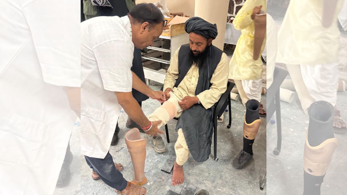 India’s ‘humanitarian’ help to Taliban-ruled Afghanistan: Medicos organise Jaipur foot camp in Kabul India’s ‘humanitarian’ help to Taliban-ruled Afghanistan: Medicos organise Jaipur foot camp in Kabul