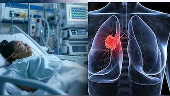 Choking before 30? 1 in 3 Delhi youth show lung abnormalities: Report