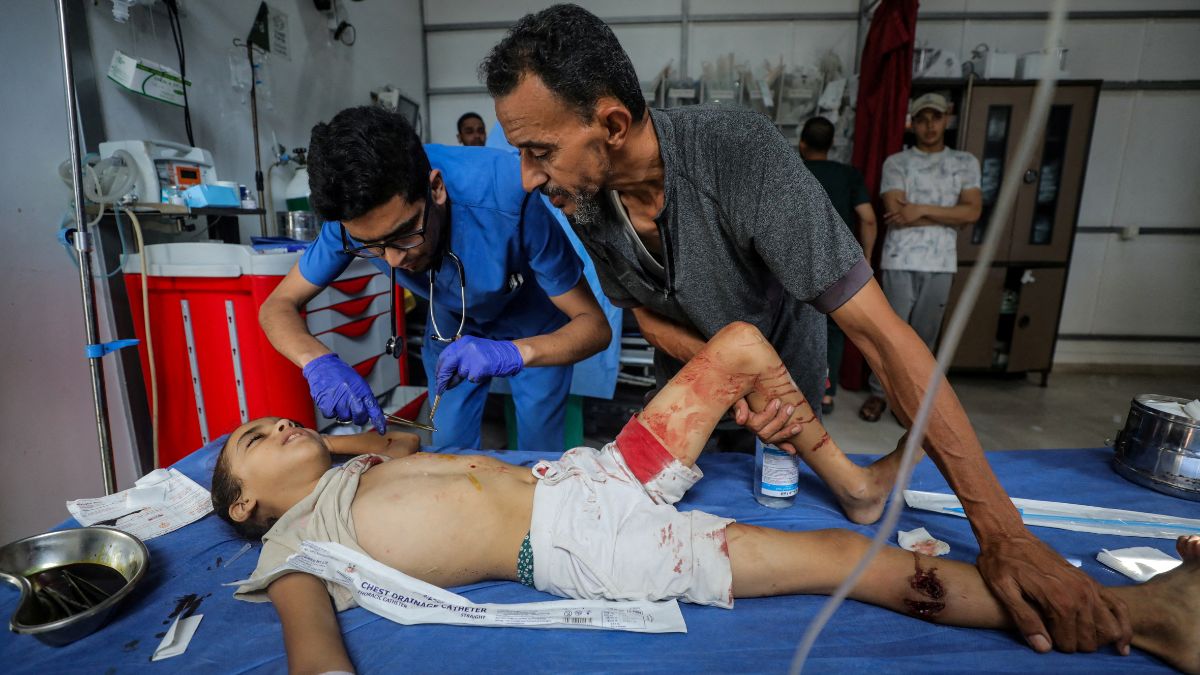 A Palestinian child, wounded in an Israeli strike that killed people, who gathered to collect water from a distribution point, according to medics, receives treatment at Al-Awda Hospital in Nuseirat in the central Gaza Strip July 13, 2025. (Reuters/Stringer)1 A Palestinian child, wounded in an Israeli strike that killed people, who gathered to collect water from a distribution point, according to medics, receives treatment at Al-Awda Hospital in Nuseirat in the central Gaza Strip July 13, 2025. (Reuters/Stringer)1