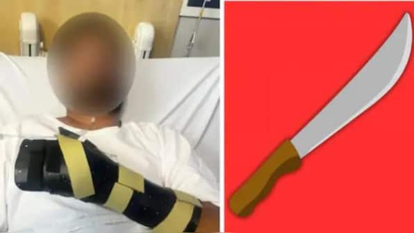 'Hand was hanging by a thread’: Indian man brutally attacked with machete in Melbourne, two accused get bail