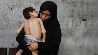 Displaced Palestinian mother Samah Matar holds her malnourished son Youssef, who suffers from cerebral palsy, at a school where they shelter amid a hunger crisis, in Gaza City. Reuters