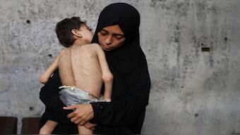 Displaced Palestinian mother Samah Matar holds her malnourished son Youssef, who suffers from cerebral palsy, at a school where they shelter amid a hunger crisis, in Gaza City. Reuters