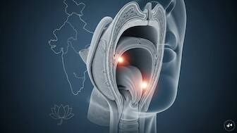 Not just smokers: Doctors flag new risk factors for throat cancer in India