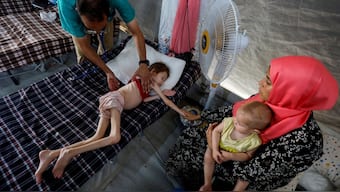A doctor checks Palestinian girl Jana Ayad, who is malnourished, according to medics, as she receives treatment at the International Medical Corps field hospital, amid the Israel-Hamas conflict, in Deir Al-Balah in the southern Gaza Strip, June 22, 2024. File Image/Reuters