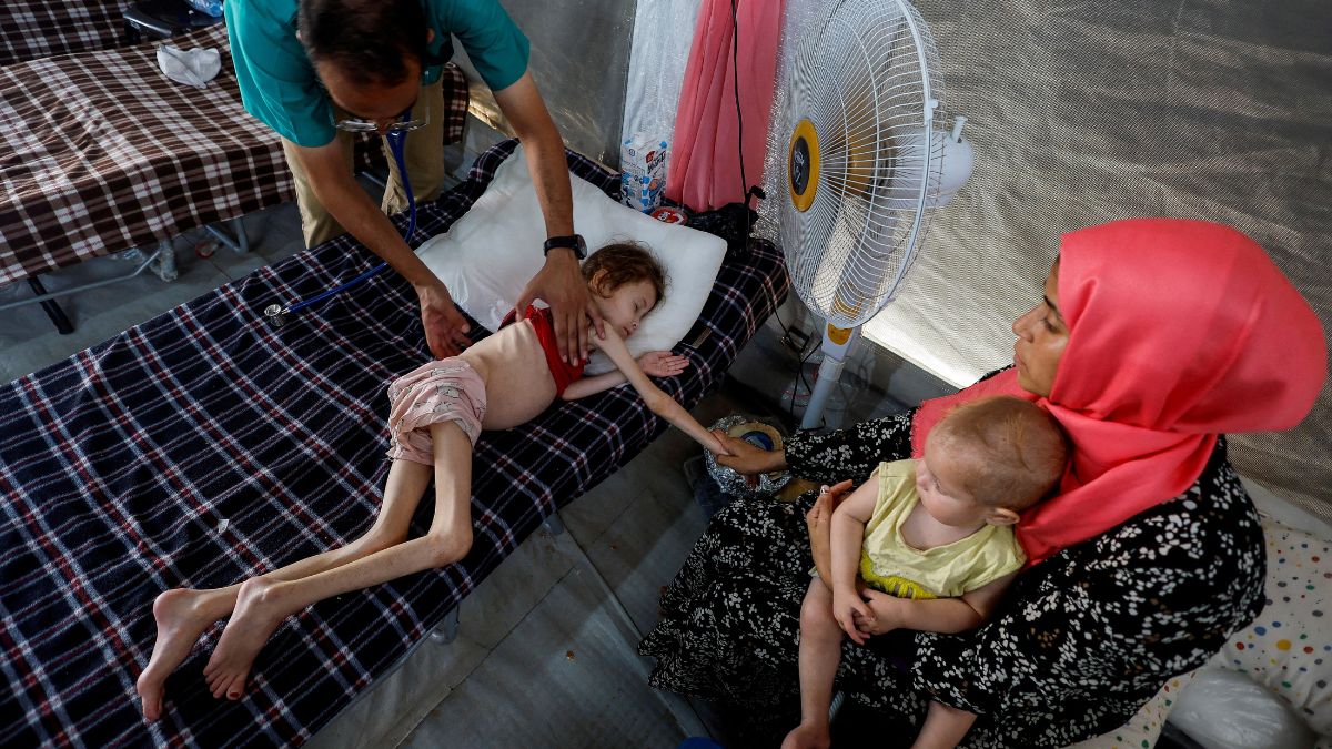 A doctor checks Palestinian girl Jana Ayad, who is malnourished, according to medics, as she receives treatment at the International Medical Corps field hospital, amid the Israel-Hamas conflict, in Deir Al-Balah in the southern Gaza Strip, June 22, 2024. File Image/Reuters A doctor checks Palestinian girl Jana Ayad, who is malnourished, according to medics, as she receives treatment at the International Medical Corps field hospital, amid the Israel-Hamas conflict, in Deir Al-Balah in the southern Gaza Strip, June 22, 2024. File Image/Reuters