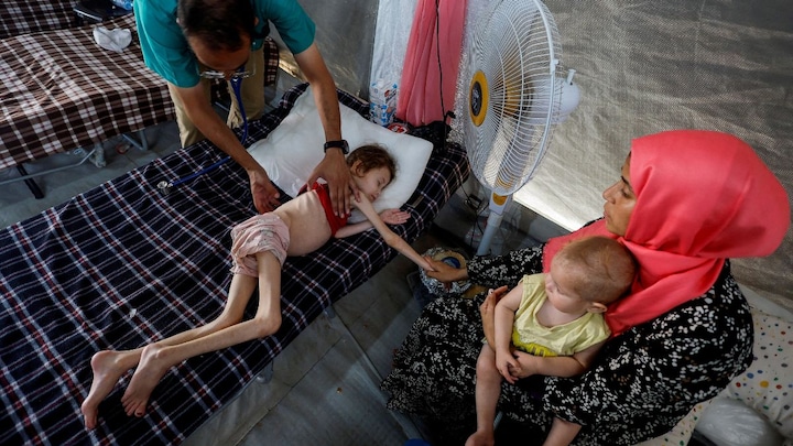 'Body eats itself': What happens when the body is starved of food