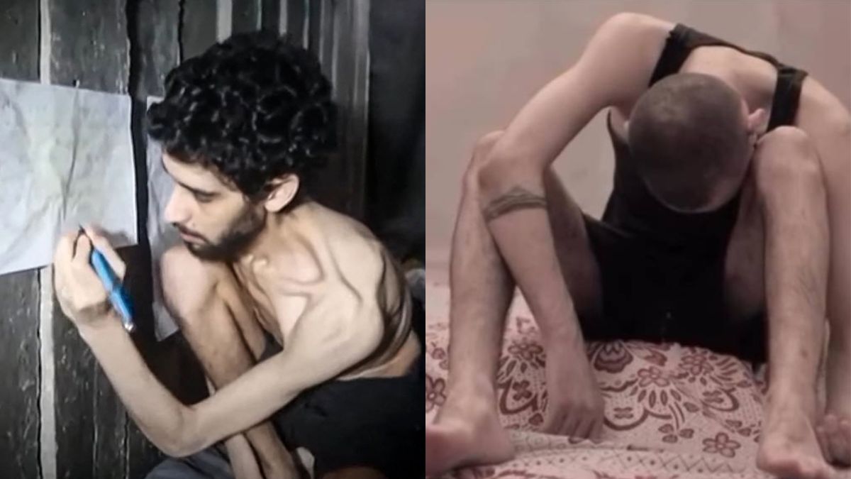 ‘Living skeleton’: Who are the two Israeli hostages seen in new videos from Gaza? ‘Living skeleton’: Who are the two Israeli hostages seen in new videos from Gaza?