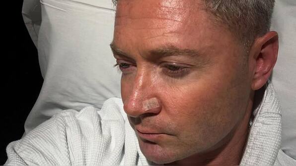 Former Australia captain Michael Clarke shares health update after another surgery for skin cancer