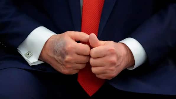 Is Donald Trump covering his bruises with makeup?