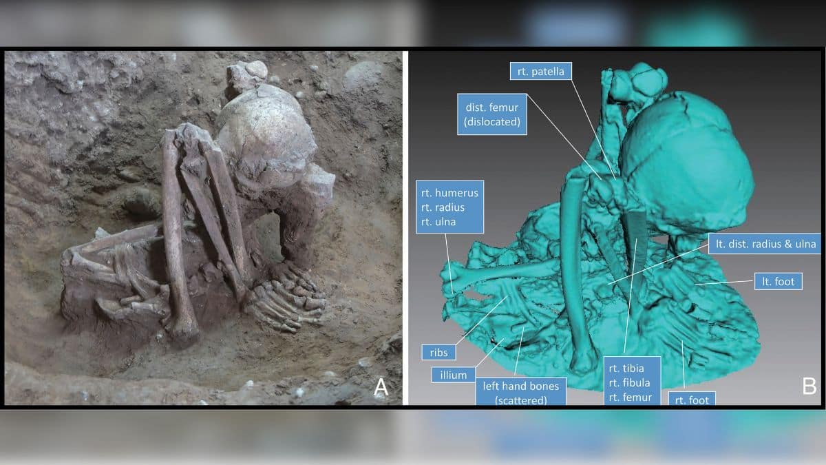 M26, a tightly flexed human burial from Huiyaotian, Guangxi, southern China. (A) Skeletal position of a middle-aged male, and (B) surface scan of Burial M26. The mostly complete skeleton retains its original articulated position. The pelvis lies on the ground, while the Right and Left femora are nearly vertical, with their distal ends oriented upward. Both knees are strongly flexed, positioning the feet just medial to the hip joints, and the foot bones are largely intact. The shoulders, rib cage, and upper limbs have collapsed downward, but the positions of the humerus, radius, and ulna indicate that the arms were crossed beneath the thighs, with each hand placed under the opposite knee. Overall, the body is folded in an extremely compact manner. Image/PNAS