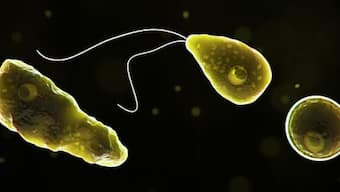 Naegleria fowleri or ‘brain-eating amoeba’, causes amoebic meningoencephalitis. Wikimedia Commons