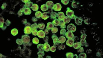 A brain-eating amoeba has killed 19 in Kerala this year. Wikimedia Commons