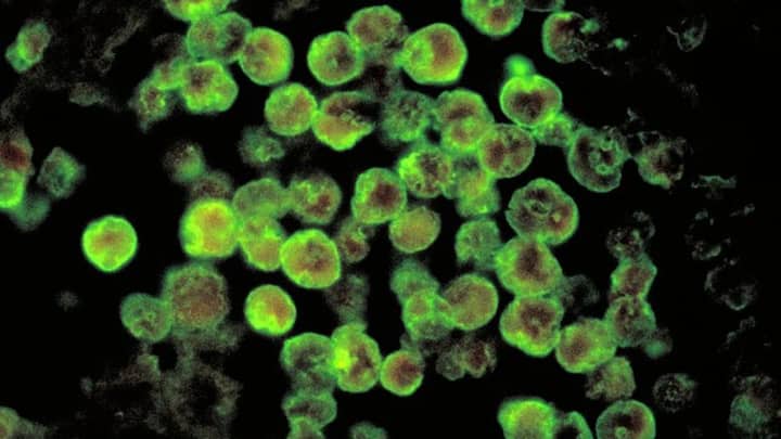 Brain-eating amoeba: Why Kerala’s survival rate trumps globally