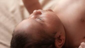 Foetus in fetu is a very rare developmental anomaly that begins early in pregnancy, when a malformed foetus is absorbed by its twin. Image for Representation.